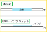 違い